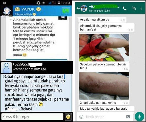 bukti-qnc-jelly-gamat-menghilangkan-kudis kudis kering setelah rutin mengoles qnc jelly gamat kisahnya melalui whatsapp & hp blackbeerry