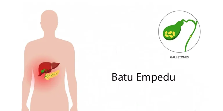 cara menghancurkan batu empedu secara alami