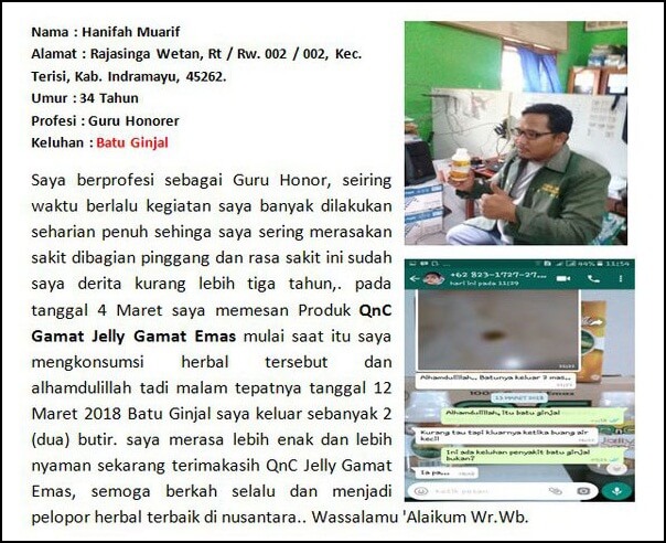pengalaman bapak hanifah muarif keluar 2 butir batu ginjal