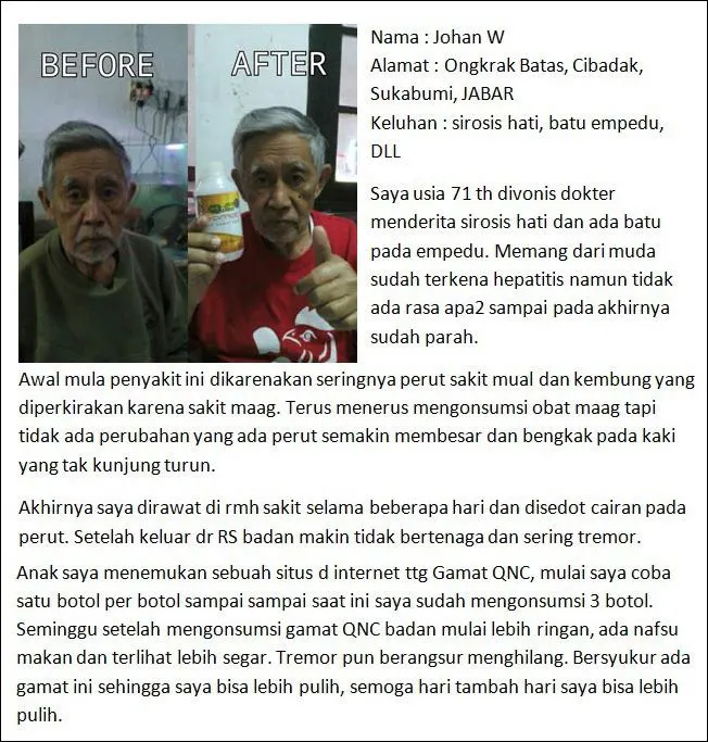 testimoni obat batu empedu herbal