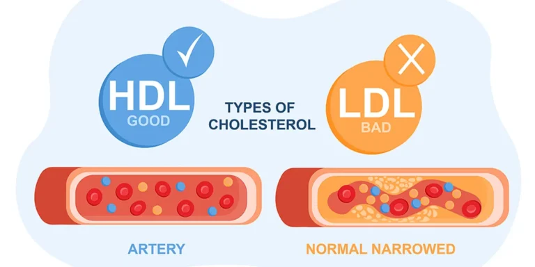 cara menurunkan kolesterol LDL