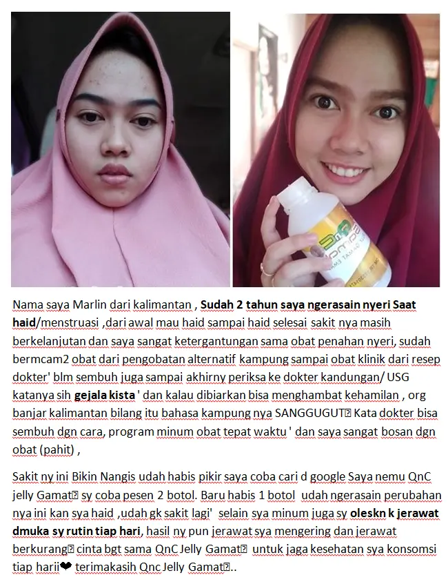testimoni qnc jelly gamat dari mbak marlin