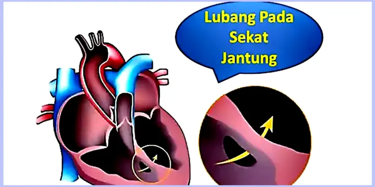 ciri-ciri jantung bocor pada anak dan dewasa