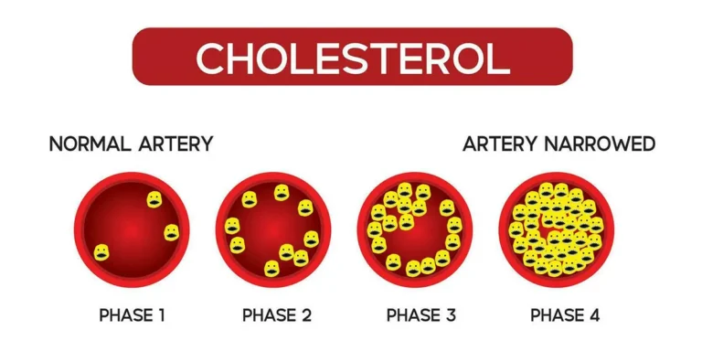 kolesterol normal dan ciri ciri kolesterol tinggi