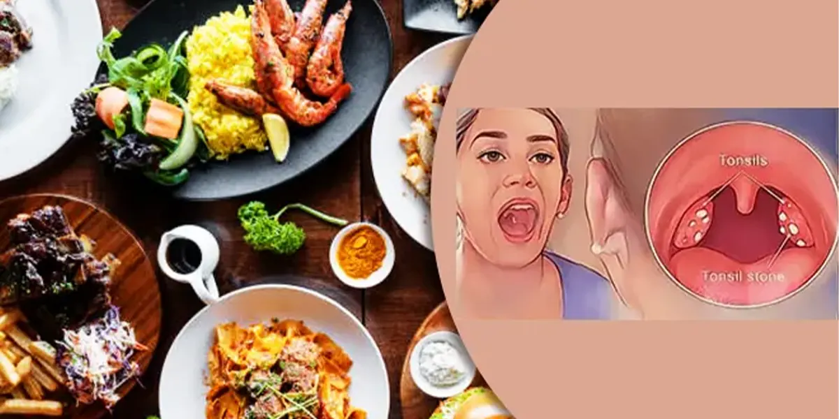 pantangan makanan radang amandel anak dan dewasa