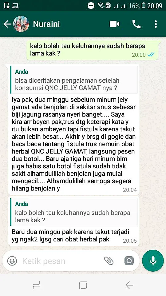 fistula ani mulai mengecil bukti dikirim melalui whatsapp