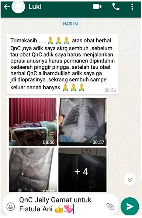 bukti kirim di whatsapp fistula ani sembuh