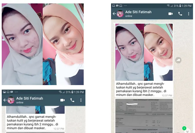 testimoni qnc jelly gamat untuk perawatan wajah